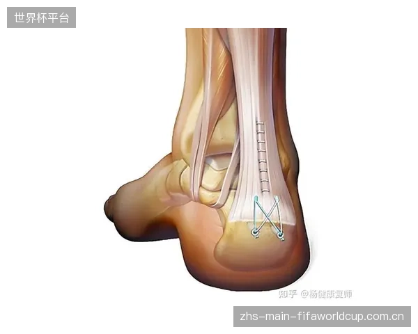 临床对比数据显示:采用AI生物力学引导的康复方案,可将运动员跟腱断裂后的平均重返赛场时间缩短约18% 临床对比数据显示:采用AI生物力学引导的康复方案,可将运动员跟腱断裂后的平均重返赛场时间缩短约18%